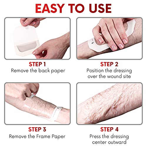 Healqu 8 x 12 Inch Transparent Waterproof Wound Dressing (10 Pack) – Breathable Post-Surgical Bandages for Sensitive Skin