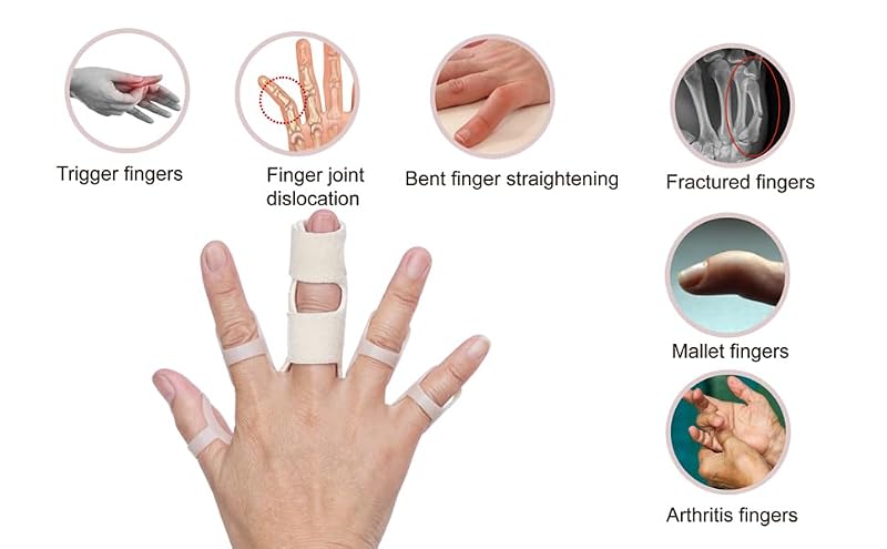Finger Splint Set - 8 Oval Splints & 2 Trigger Finger Splints - Sizes 7-14