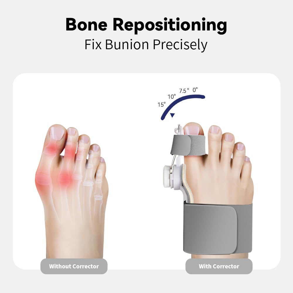 XRUIDI Bunion Corrector for Women & Men Adjustable Big Toe Splint for Hallux Valgus Relief & Toe Alignment, Orthopedic Brace for Pain Relief & Toe Alignment Fits Left & Right Feet 1 PACK