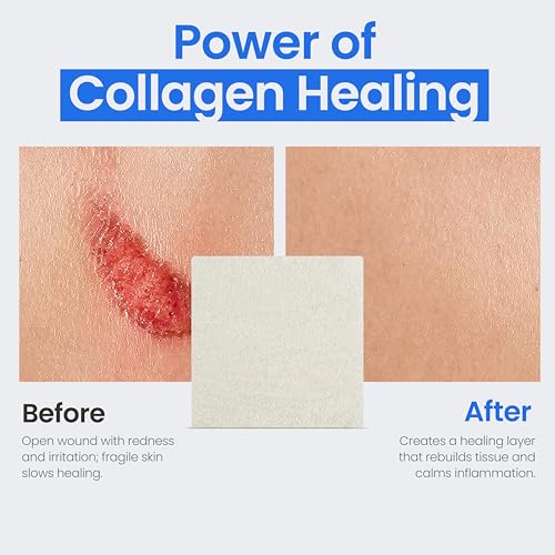 SimPurity 2" x 2" Collagen Wound Dressing Pads – 5 Count (5 Pads), Bovine Collagen