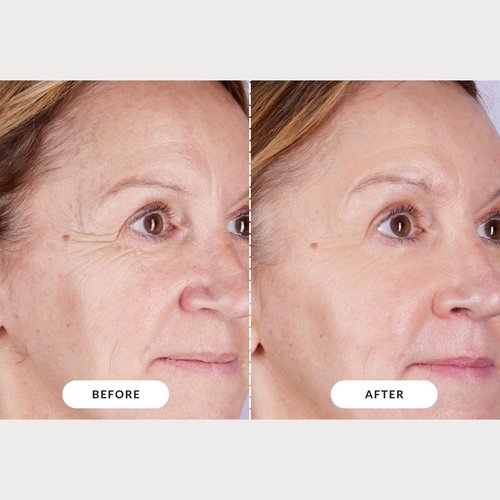 CurrentBody Skin LED Light Therapy Mask - Advanced Skin Rejuvenation | Series 2