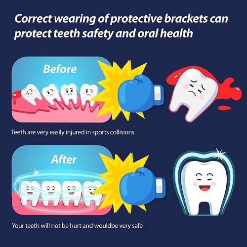 Youth Mouth Guard Football Sport Mouthguard, Premium Quality No Boiling Required,Suitable for Basketball, Wrestling, Taekwondo, Jujitsu and Karate (Blue)