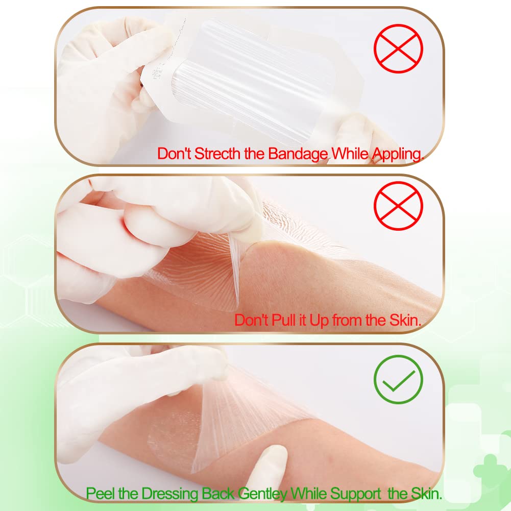 NeuHeils Transparent Film Dressing 2 3/8'' x 2 3/4'', 100 Pack, Waterproof Wound Cover Bandage, Clear IV Catheter Tape, Adhesive Patch, Shower Shield