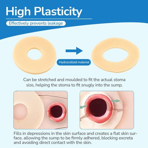10PCS Ostomy Barrier Rings, Ostomy Supplies, 4mm Thickness Moldable Ostomy Rings Medical Grade Hydrocolloid Adhesive Barrier Rings Better Seal for Ostomy Bags (Box of 10)