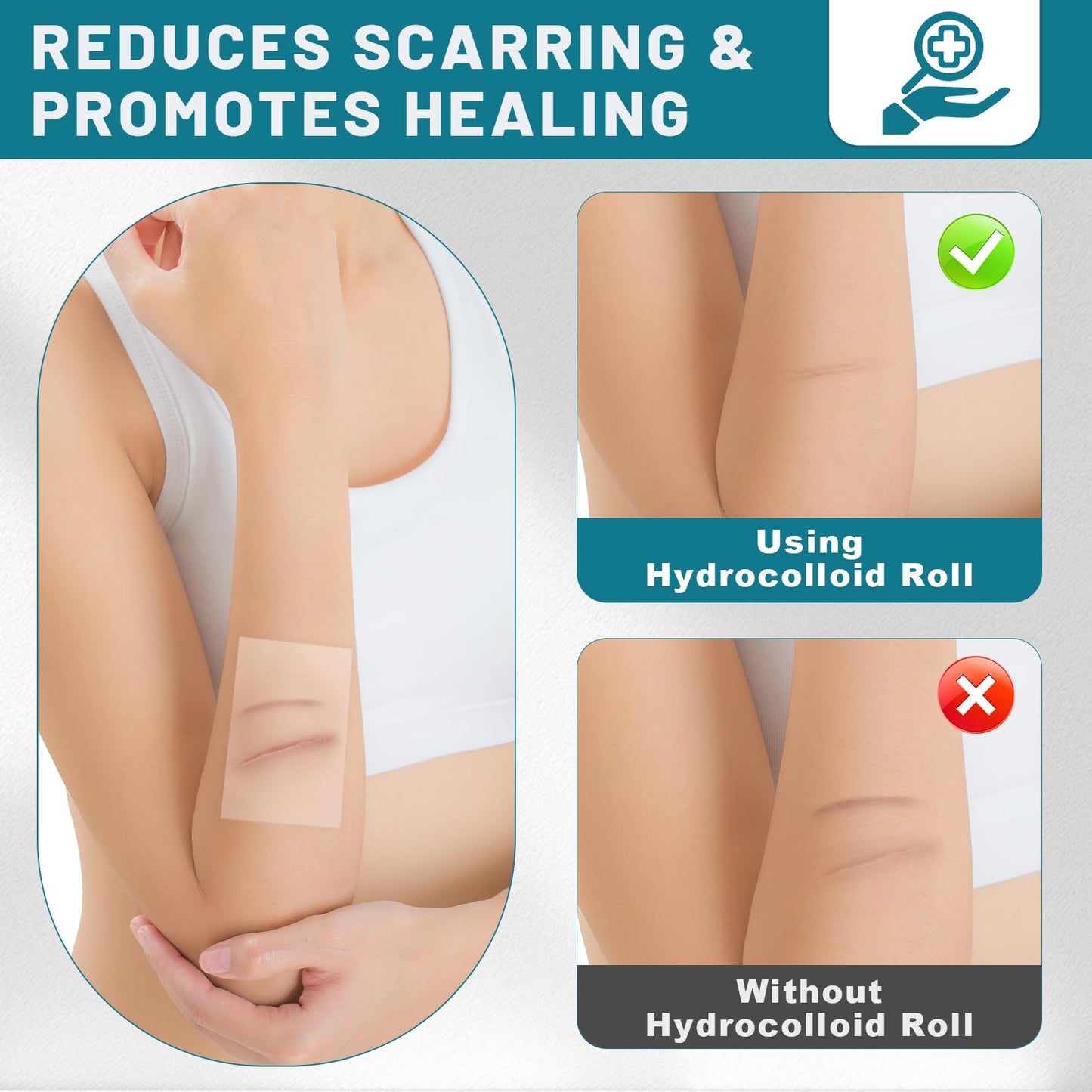 Hydrocolloid Roll for Wound Care, 2in*16.5ft Hydrocolloid Bandages with Self-Adhesive, Extra Large Hydrocolloid Patch Bandages Cut-to-Size, Ultra Absorbent, Waterproof