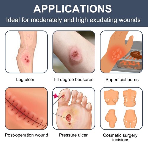 LotFancy Calcium Alginate Wound Dressing, 4”x8” Patches, 10 Count, Sterile Non-Stick Padding, Highly Absorbent Wound Dressings Pads for Emergency Care, Fast Healing