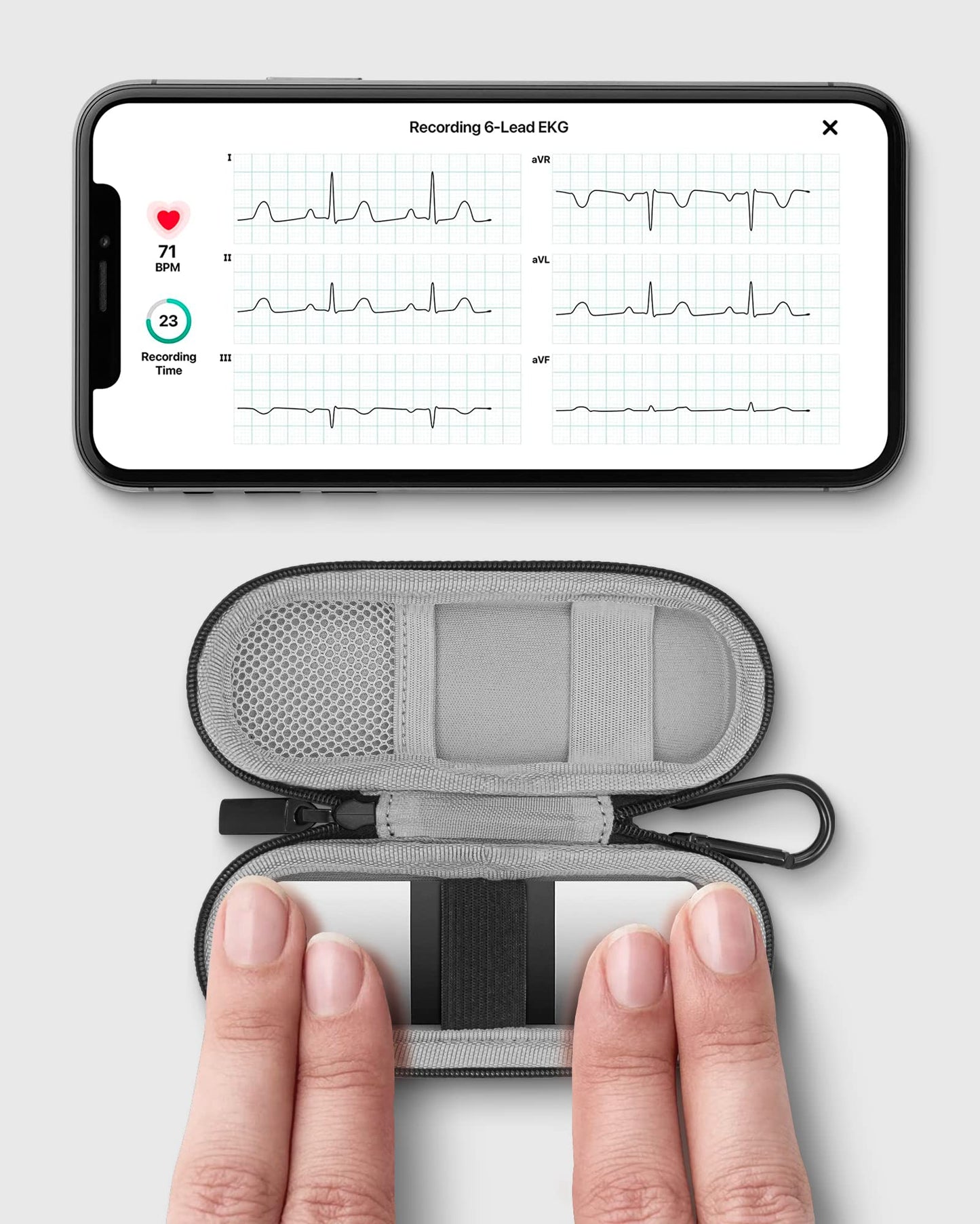 Heart Monitor Case for AliveCor KardiaMobile 6L and Kardia Mobile EKG Monitor, Travel case for AliveCor Kardia Mobile 1-Lead Personal EKG/KardiaMobile 6-Lead Personal EKG