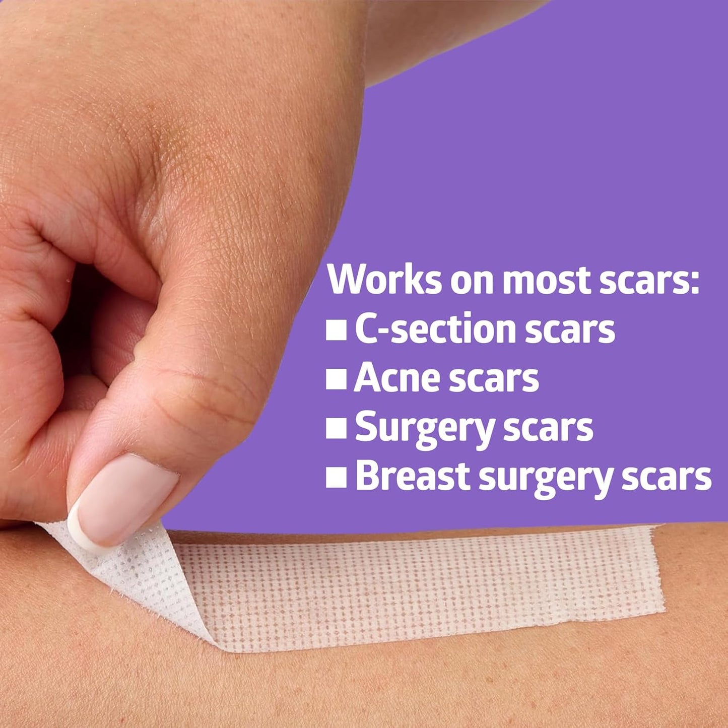 Medline Gentac EZ Silicone Tape - Easy Tear Medical Tape for Sensitive Skin | 1” x 5.5 Yards
