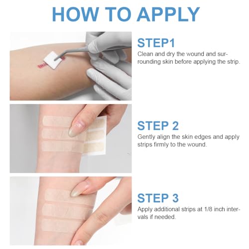 Breathable Adhesive Wound Closure Strips - 30 Pack