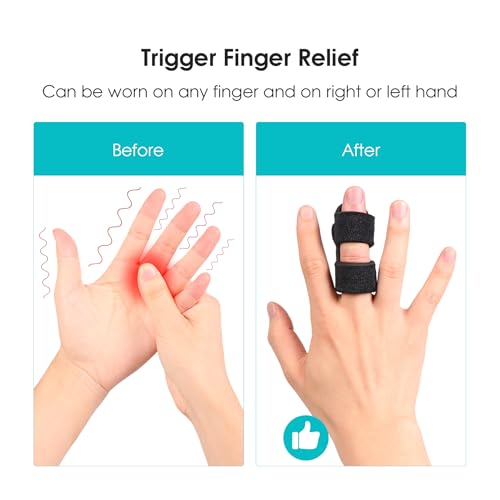 Universal Finger Splint Brace for Arthritis & Sprain Relief - 2 Pack