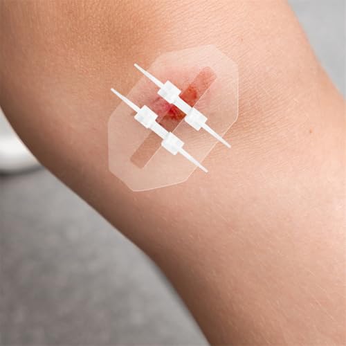 Emergency Wound Closure Strips - 2PCS Zip Stitch Kit, 6x7cm
