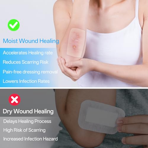 Hydrocolloid Wound Care Roll - 2 Pack, 2in x 17ft Cut-to-Size Adhesive Patch