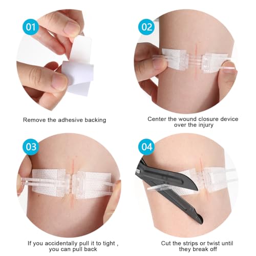 Sterile Wound Closure Strips - 5PCS First Aid Adhesive Bandages