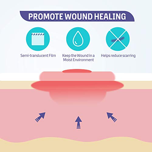 Hydrocolloid Wound Dressing - 4" x 4" Self-Adhesive, 10 Pack