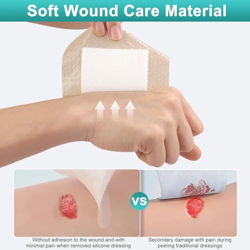 CAKRNPS Dark Beige Silicone Foam Wound Dressings 4x4 Inch Pack of 10 – Waterproof, Self-Adhesive, Hypoallergenic for Bed Sores & Exuding Wounds