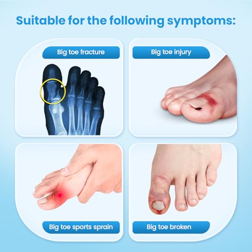 Beige Left Big Toe Splint Support Brace for Fracture & Injury Recovery