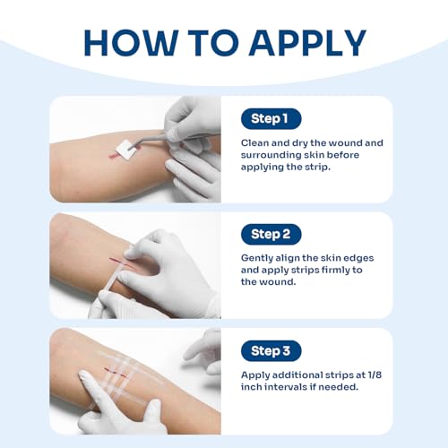 40 Breathable Wound Closure Strips for Secure Healing