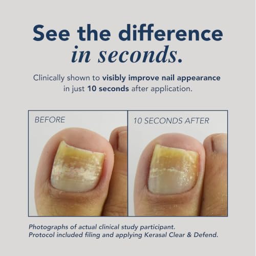 Kerasal Clear & Defend Fungal Nail Renewal Kit 0.13 oz + 5 Files - Clear + Defend