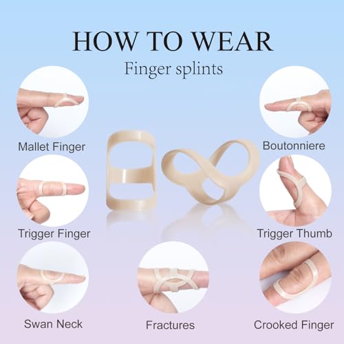 Large Oval Finger Splints 8pcs for Arthritis & Trigger Finger