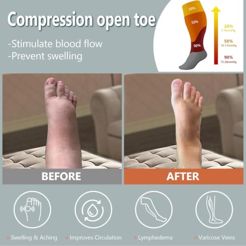 Abodhu Plus Size Compression Socks Open Toe for Women& Men 15-20mmHg