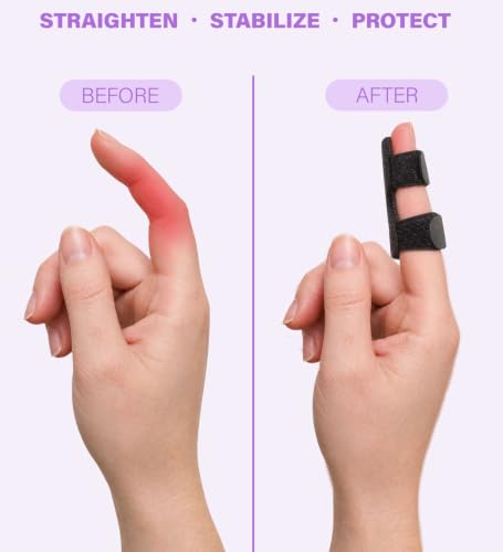 Finger Splint with Aluminum Support - 2 Pack - Trigger Finger Brace - Long/Black
