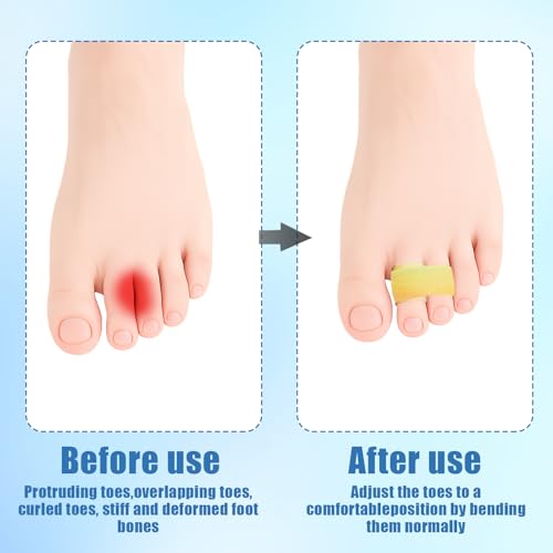 10 Pcs Rainbow Color Buddy Tape Finger Straps - Washable Splint