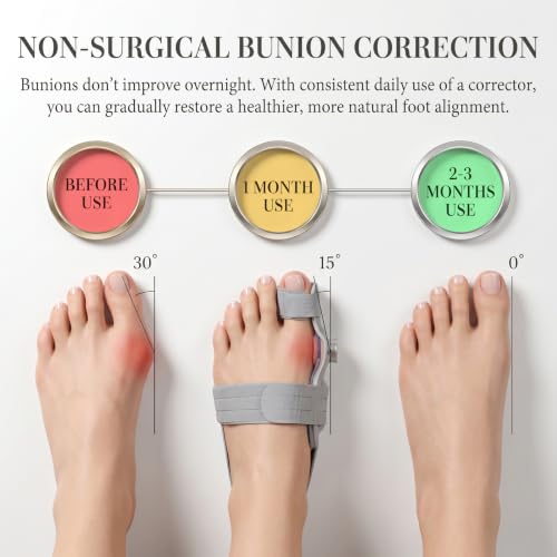 Gray 2-Pack Bunion Corrector & Silicone Toe Separators for Hallux Valgus, Overlapping Toes, Hammer Toe Relief — Adjustable Knob & Day Use