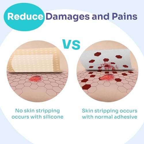 2" x 2" Silicone Foam Dressings - Large Bandages, 10 Pack
