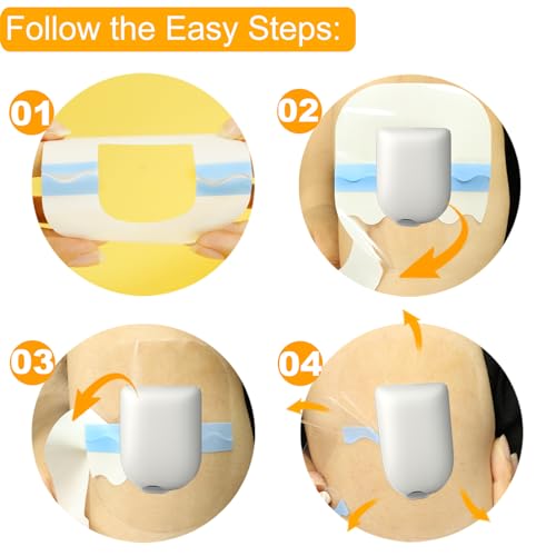 40 Pack Waterproof Omnipod 5 Overpatches - Clear Adhesive Patches for Insulin Pods, Hypoallergenic, Extended Wear