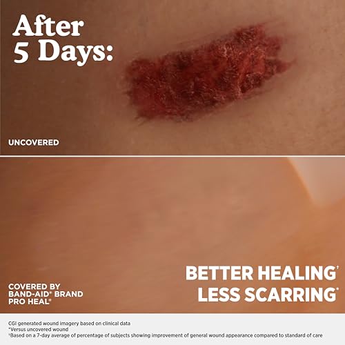 Hydrocolloid Blister Bandages - 6 Count | Waterproof Healing Protection