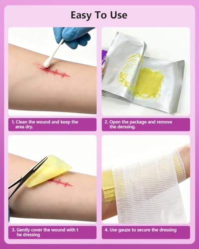 Vynive Xeroform Petrolatum Wound Dressing 5x9 Inch Pack of 25, Non-Adherent Gauze for Large Wounds