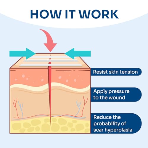 40 Breathable Wound Closure Strips for Secure Healing
