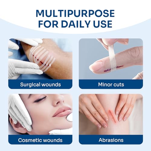 40 Breathable Wound Closure Strips for Secure Healing