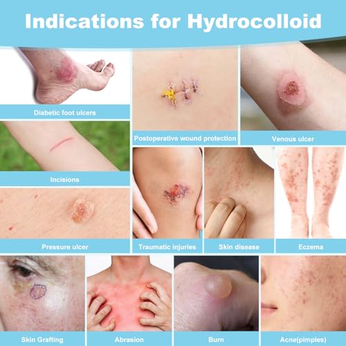 Hydrocolloid Roll Bandage - 2in x 12ft Waterproof Adhesive Dressing
