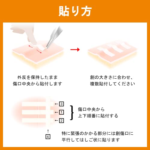 Reinforced Skin Closure Strips - 1/4" x 4" - 10 Count