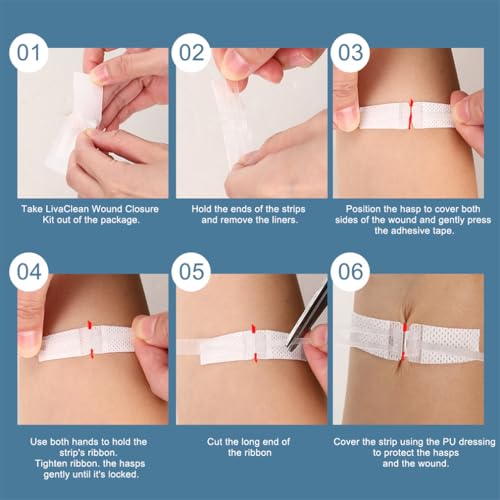 Butterfly Wound Closure Strips - 3 Pack Emergency Bandages
