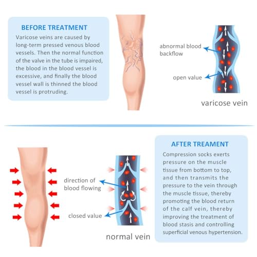 XUANSHOW 20-30mmHg Compression Pantyhose for Women, High-WaistOpaque Stockings, S/M Mix-2Pairs