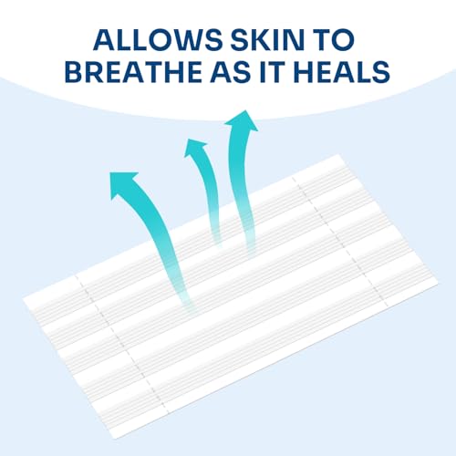 40 Breathable Wound Closure Strips for Secure Healing