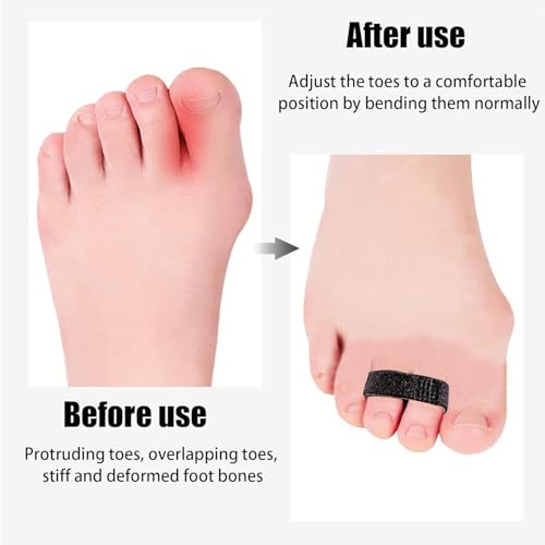 Finger Straps Buddy Tape 10 Pack - No Slip Padded Support for Injured Fingers - One Size / Black