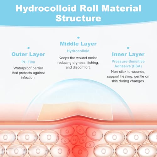 Hydrocolloid Roll Bandage - 2in x 12ft Waterproof Adhesive Dressing