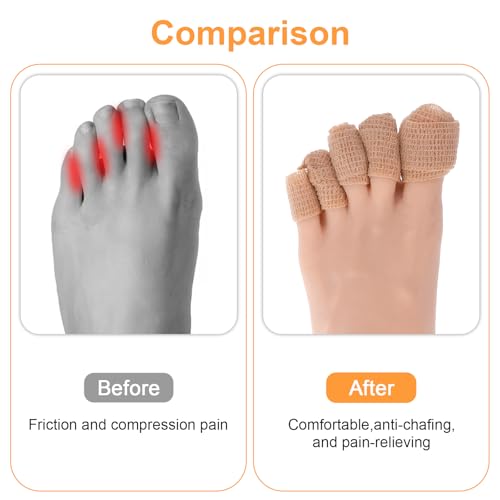 1 Inch Big Toe Protectors - 8 Rolls Self-Adhesive Bandage - Nude