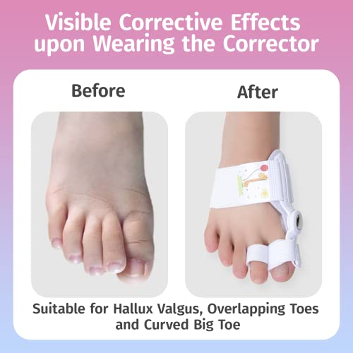 Kids Bunion Corrector Adjustable Splint with Silicone - Orthopedic Toe Straightener for Hallux Valgus