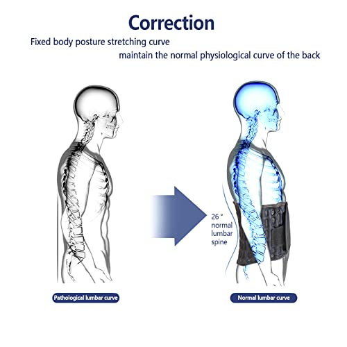 Blue Decompression Back Belt with Lumbar Support for Pain Relief, 29-49 in Waist – One Size