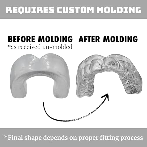 Lightweight Boil-and-Bite Mouthguard for Contact Sports