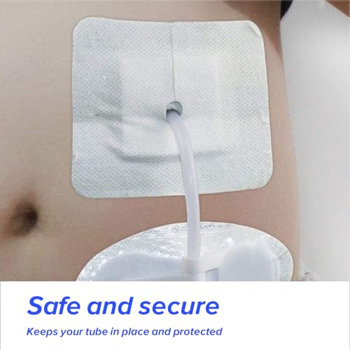 15 Pcs Split Adhesive Feeding Tube Bandages - Sterile Catheter Covers