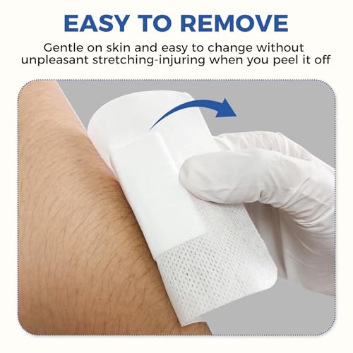 2"x2" Island Dressing Gauze Pads - 30 Individually Packed