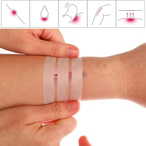 Emergency Wound Closure Tape - 24pcs Adhesive Strips 12x100mm