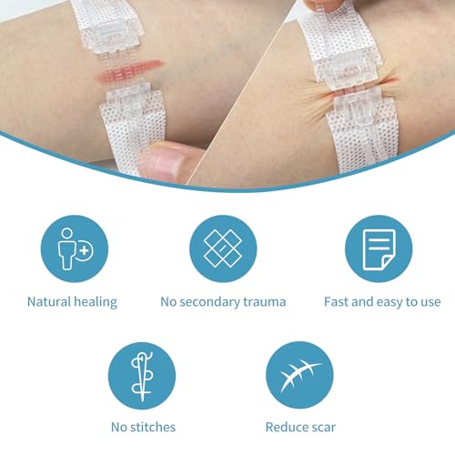 Zip Stitch Wound Closure Strips - 1.5x8cm Emergency Kit
