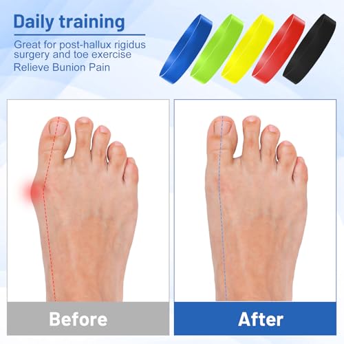 Toe Spacers and Stretch Bands - 5pcs Resistance Bands Set