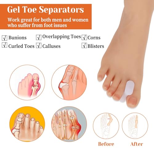 12-Piece Bunion Corrector Gel Toe Separators - Soft Toe Spacers